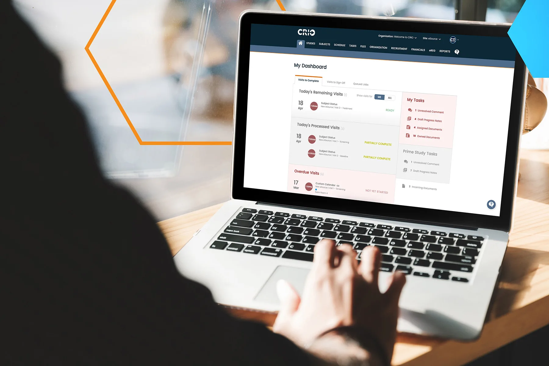 A photograph of a person’s hands poised over a laptop keyboard, the screen displaying the CRIO web application “My Dashboard” page. The top navigation bar shows the CRIO logo at left, menu items (Studies, Subjects, Schedule, Tasks, Files, Organization, Recruitment, Financials, eReg, Reports), and a user avatar at right. Below, a white title bar reads “My Dashboard.” The main panel is divided into three cards under a “Visits to Complete” tab:

Today’s Remaining Visits (1):
– “18 Apr” date label with a red 7:30 AM time badge, “Subject vSource | Visit 3 – Treatment,” status “READY.”

Today’s Processed Visits (2):
– “18 Apr” with a maroon 7:00 AM badge for “Subject vSource | Visit 1 – Screening,” “PARTIALLY COMPLETE” in yellow-green.
– A second entry “18 Apr” with a maroon 7:00 AM badge for “Subject vSource | Visit 2 – Baseline,” “PARTIALLY COMPLETE.”

Overdue Visits (6):
– “17 Mar” with a pink 1:30 PM badge for “Custom Calendar cc | New eSource | Visit 1 – Screening,” status “NOT YET STARTED.”

On the right sidebar titled “My Tasks,” pink and gray boxes show counts for “Unresolved Comment,” “Draft Progress Notes,” “Assigned Documents,” and “Owned Documents.” Beneath, “Prime Study Tasks” lists similar items. The overall scene is set on a wooden desk with the background softly out of focus.